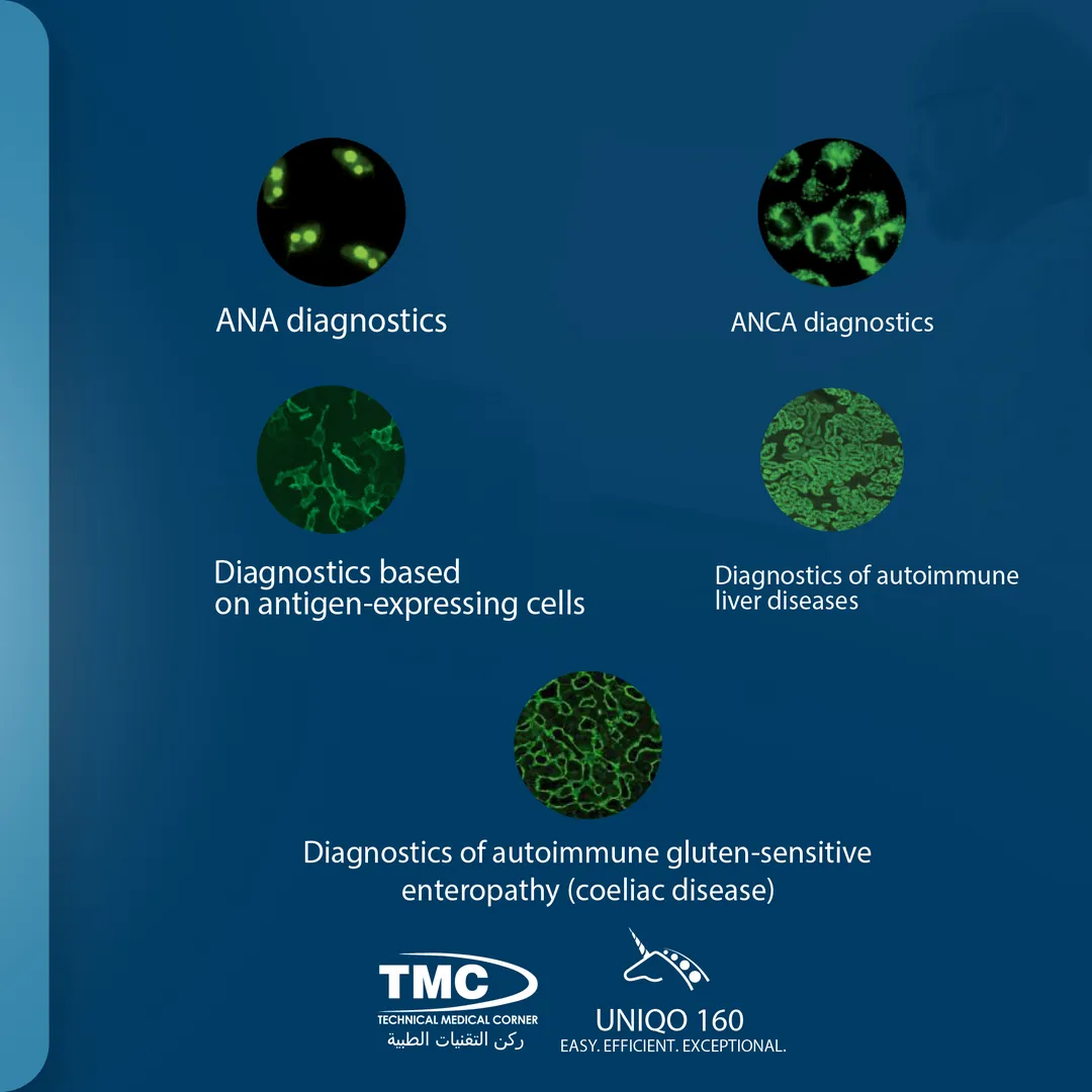 UNIQO 160 application areas: ANA, ANCA, antigen-expressing cells, autoimmune liver disease and coeliac disease