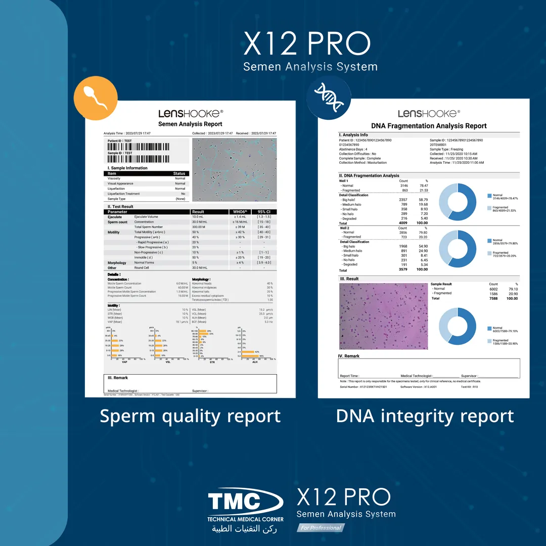 LensHooke X12 PRO sample reports: a semen analysis report and a DNA fragmentation analysis report