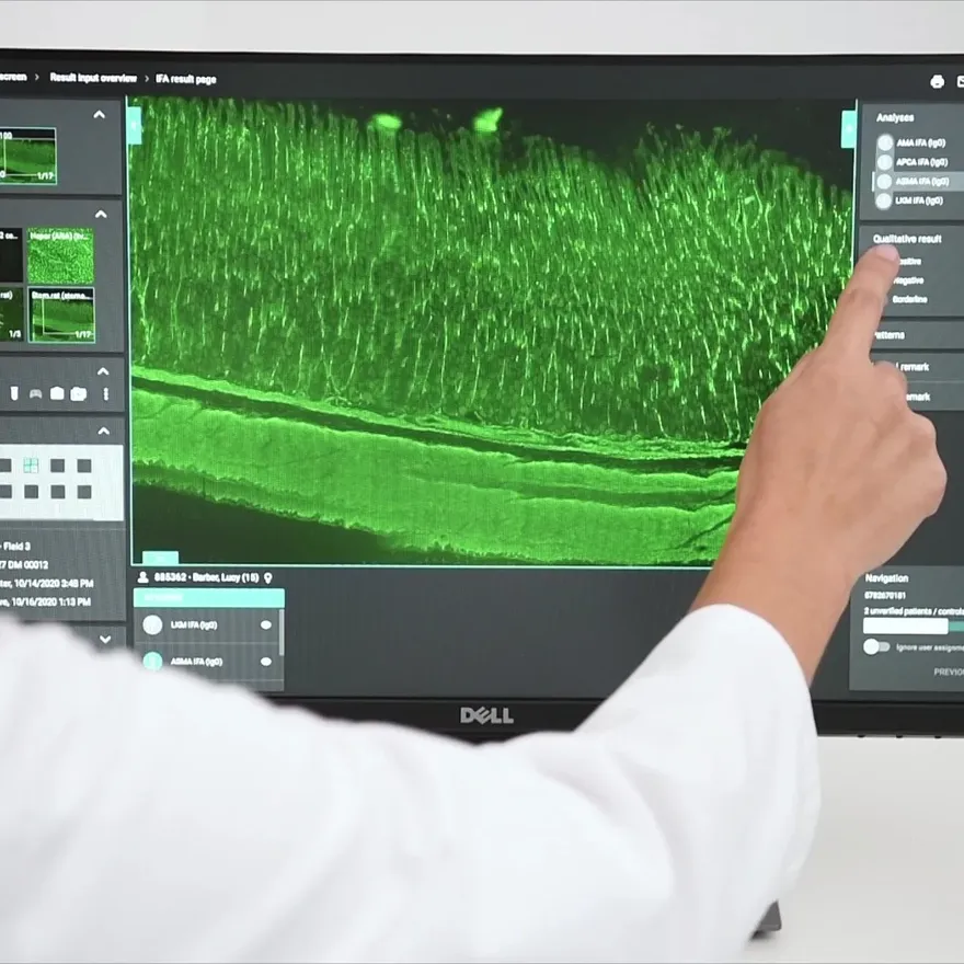 نظام EUROPattern Microscope Live من EUROIMMUN: مختصّة تراجع صورة فلورة مناعية على الشاشة اللمسية